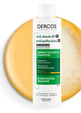 does dandruff cause hair loss