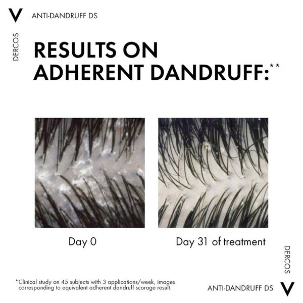 anti-dandruff-shampoo-sensitive-scalp-pack3